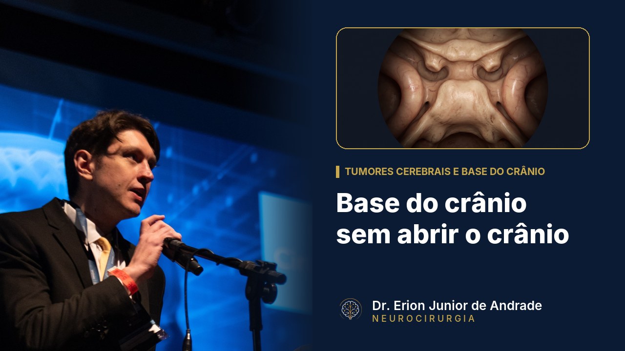 Cirurgia da base do crânio sem abrir o crânio: como funciona?