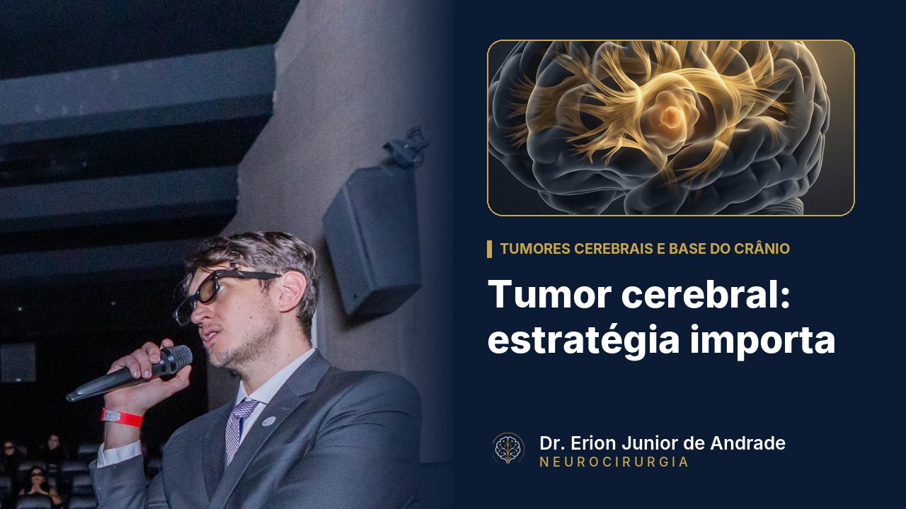 Tumor cerebral: por que a estratégia importa além da técnica
